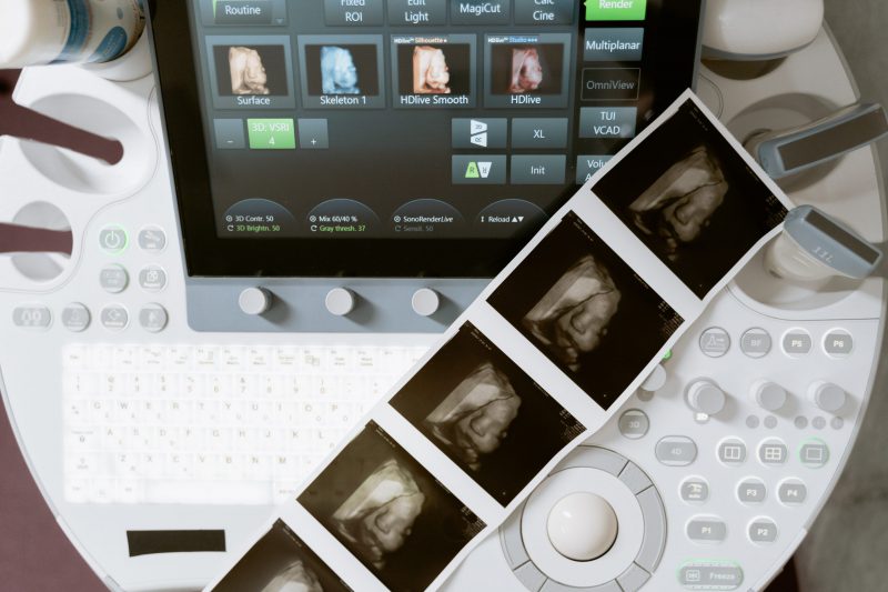 ultrasound photos on a keyboard